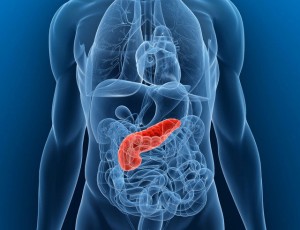 Tumore del Pancreas